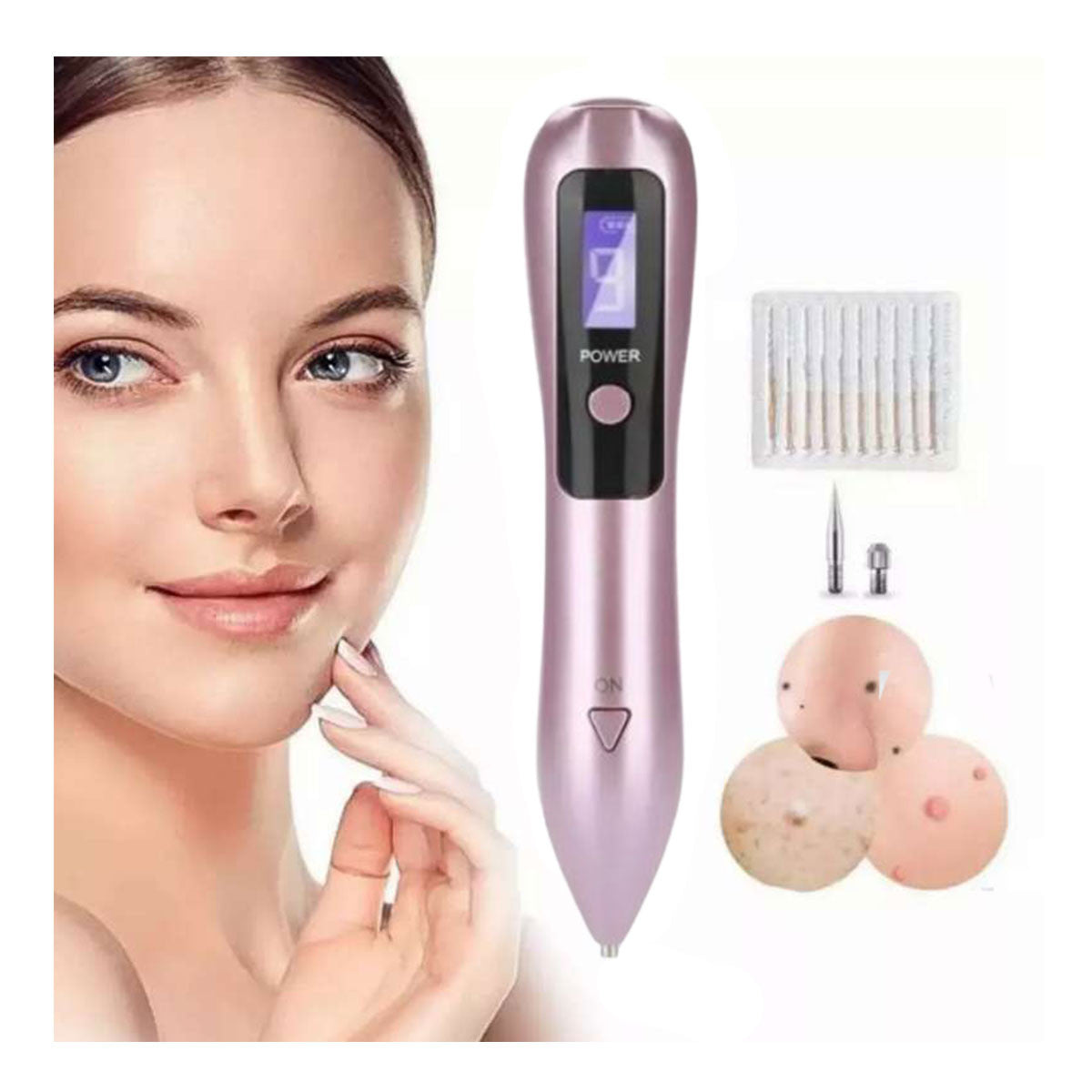 CAUTERIZADOR RECARGABLE QUITA VERRUGAS